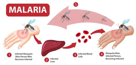 Malaria Symptoms, Malaria Prevention, Malaria Parasite, Fluorescence Microscopy, Mosquito Bites, Mosquito Bite, Class 8, Brain Damage, Collaborative Learning