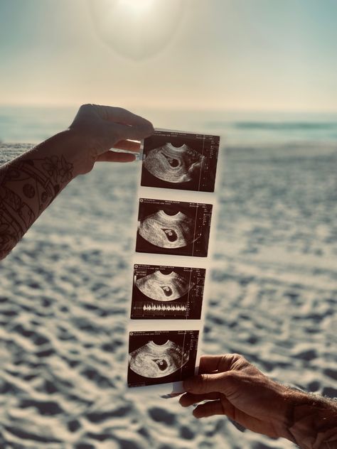 #ultrasound #pregnancy #momtobe #beach #dad #excited #peanut Sonogram Picture Ideas Beach, First Ultrasound Picture Ideas, Fall Beach Pregnancy Announcement, Beach Ultrasound Announcement, Lake Baby Announcement, Beach Baby Announcement Pictures, Pregnancy Announcement On The Beach, Baby Announcement On Beach, Gender Reveal On Beach