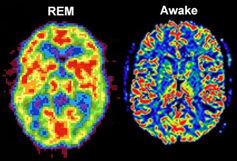 rem brain vs awake brain Neuro Science, Brain Sleep, Deep Sleep Meditation, Brain Activity, Brain Scan, Rem Sleep, Rhythmic Pattern, Brain Cells, Wide Awake