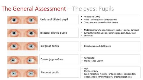 The Paramedic Neurological Assessment Nremt Emt Patient Assessment, Emt Cheat Sheets, Paramedic Tips, Paramedic Science, Paramedic Notes, Medic School, Student Paramedic, Neurology Nursing, Neurological Assessment