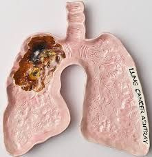 Artist: Becky Howland. Omdat longkanker een dagelijks object wordt. BRON: https://www.artsy.net/artist/becky-howland Lung Sculpture, Lung Ashtray, Constantine Aesthetic, Grandma Activities, Ashtray Ceramic, High Antioxidant Foods, Brain Healthy Foods, Eating Organic, Brain Food