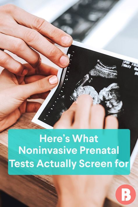 Nipt Test, Questions For First Prenatal Visit, Prenatal Exercises Second Trimester, Patau Syndrome, First Prenatal Visit, Spotting During Pregnancy, First Response Pregnancy Test, Prenatal Vitamins Before Pregnancy Trying To Conceive, Pregnancy Survival Kit