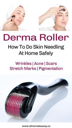 Derma Roller Before And After, Derma Roller At Home, Derma Rolling, Skin Roller, Skin Needling, Lotion For Oily Skin, Micro Needle, Natural Sleep Remedies, Moisturizer For Oily Skin