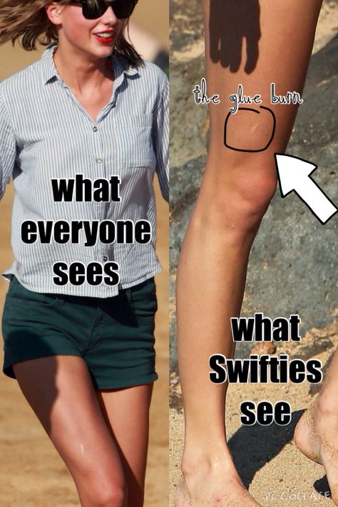 Yep, the glue gun scar from the popsicle stick castle Swift Facts, Taylor Swift Facts, Taylor Swift Funny, Are You Okay, Popsicle Stick, Celebrity Design, Red Taylor, Swift 3, Long Live Taylor Swift