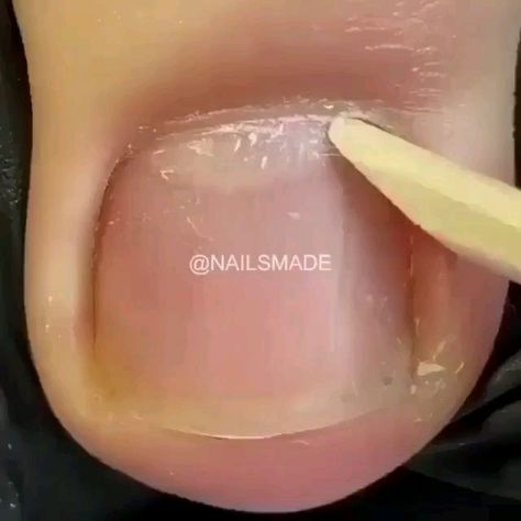 735 Me gusta, 2 comentarios - Nails art (@best_nailsartt) en Instagram: "1 or 2? Watch more videos ❤👉🏻 ( @best_nailsartt ) Follow me for more ❤👉🏻 ( @best_nailsartt ) -…" Sunset Music, Beading Art, Nail Tutorial Videos, Milky Nails, Pretty Toe Nails, Music Vinyl, Nail Techniques, Diy Acrylic Nails, Gel Nails Diy