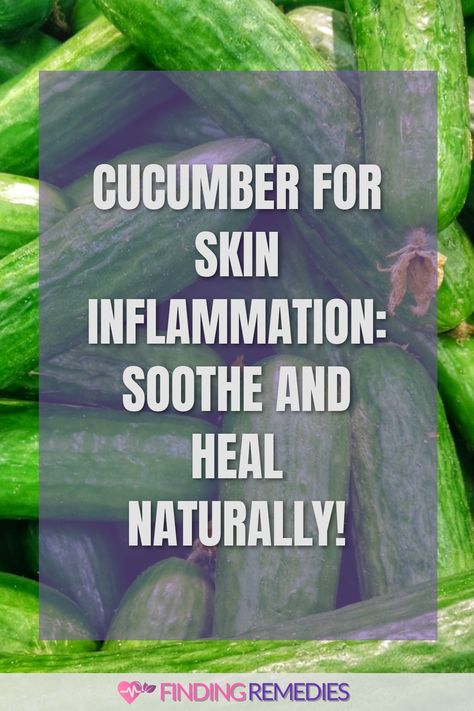 Cucumber for Skin Inflammation: Soothe and Heal Naturally! Swollen Eye Remedies, Remedies For Inflammation, Cucumber For Skin, Cucumber On Eyes, Diy Remedies, Natural Remedy, Healing Process, Holistic Healing, Calm Down