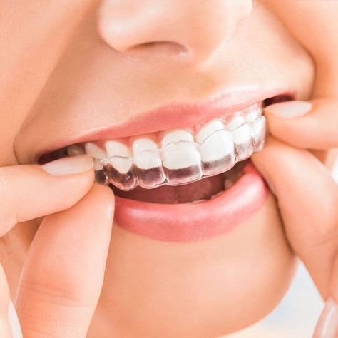 Braces Cost, Invisalign Aligners, Invisalign Braces, Teeth Alignment, Invisible Braces, Clear Braces, Clear Aligners, Teeth Straightening, Dental Cosmetics