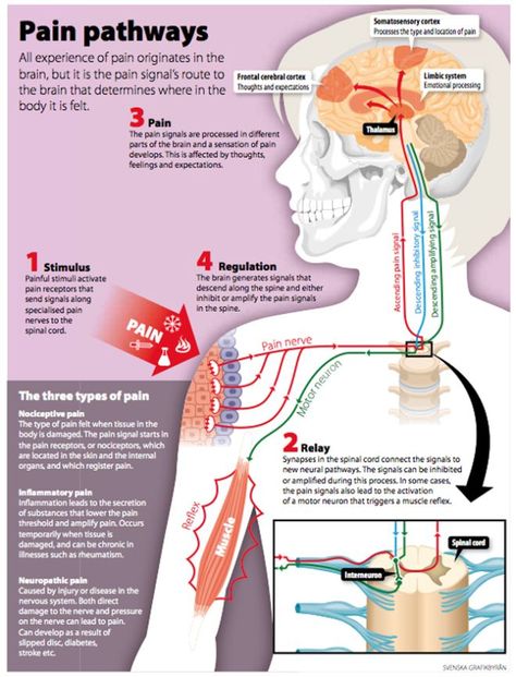 Pain-Pathways #painmanagement #pain #management Sistem Saraf, Tens Unit, Chronic Pain Relief, Ten Unit, Nerve Pain Relief, Medical School Studying, Nursing School Notes, Human Anatomy And Physiology, Medical Anatomy