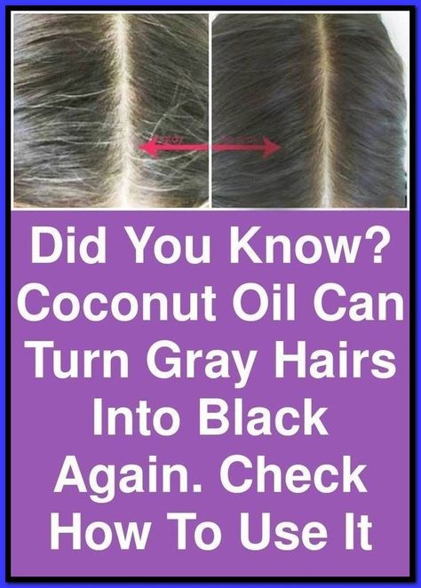 Prevent Grey Hair, Exfoliate Scalp, Straightening Natural Hair, Natural Hair Conditioner, Coconut Oil For Acne, Benefits Of Coconut Oil, Hair Remedies, Hair Black, Strong Hair