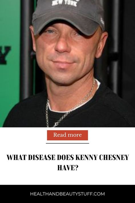 What Disease Does Kenny Chesney Have? Catchy Songs, Health Challenges, Health Tips For Women, Kenny Chesney, Health Challenge, Kids Health, Mens Health, High Energy, Big Star