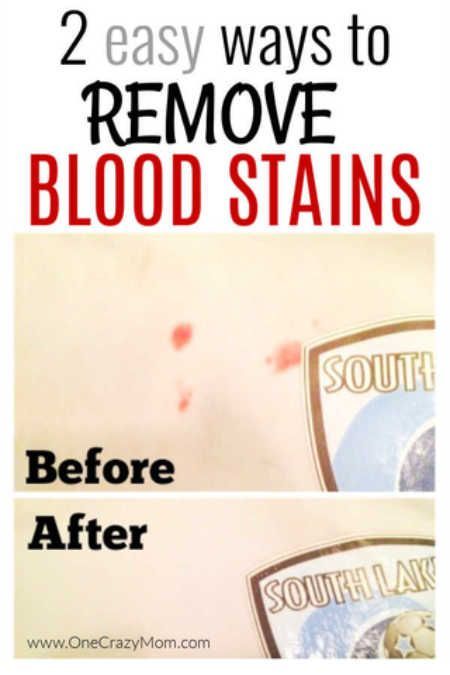 Remove Blood Stains, Homemade Toilet Cleaner, Clean Baking Pans, Cleaning Painted Walls, Deep Cleaning Tips, Stain Removal, Clean Dishwasher, Simple Life Hacks, Toilet Cleaning