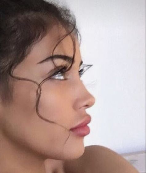 Perfect Jawline, Job Inspiration, Perfect Nose, Facial Fillers, Nose Surgery, Button Nose, Cindy Kimberly, Nose Job, Cosmetic Procedures