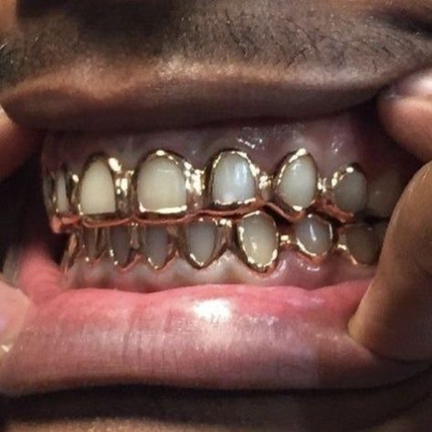 Girl Grillz, Dental Jewelry, Grillz Teeth, Diamond Grillz, Diamond Teeth, Dope Jewelry Accessories, Gold Grillz, Grills Teeth, Tooth Gem