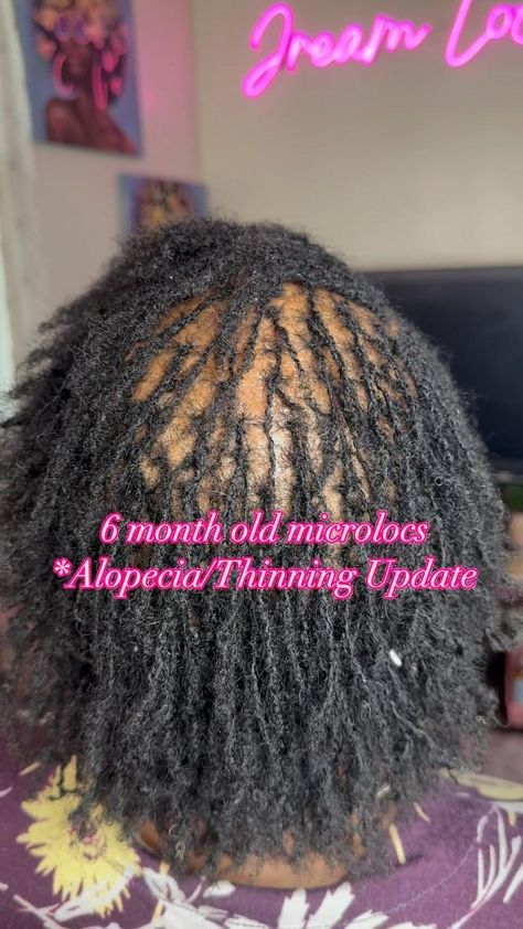 My beautiful client thought locs would not be possible for her. Yet here we are, 6 months later. THRIVING!!🥰🥹🙌🏾 Acceptance is a beautiful thing. You dont have to hide. If you have thinning or alopecia, are tired of wigs, weaves and braids and are considering locs then lets chat😉 ✨Book reopen for installs Sept 1st. ✨Get on the waitlist NOW! Who’s next??? 🤔 Get on my waitlist for fall consultations 🍁🍂🍁🍂 DM or TEXT 216-505-8665 for more info!! .⁣ .⁣ .⁣ . #MicroLocs #LocLove #TinyTwists #Nat... Locs With Alopecia, Lets Chat, Micro Locs, 6 Month Olds, Loc Styles, Locs, 6 Months, Wigs, Braids