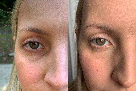 biossance-eye-gel-before-after Tattoo Moon, Swollen Eyes, Tighter Skin, Moon Crescent, Best Eye Cream, Dry Skin Patches, Eye Creams, Dark Circles Under Eyes, Eyes Problems