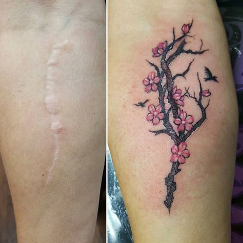 I had a blast doing this lovely lady's first tattoo covering this old scar! #scarcoverup #coveruptattoo #coverup #tattoo #tattooartist #cherryblossom Tattoo Covering, Tatuaje Cover Up, Tattoo Over Scar, Tattoo Artists Near Me, Scar Cover Up, Coverup Tattoo, Tattoos To Cover Scars, Scar Tattoo, Tattoo Cover Up