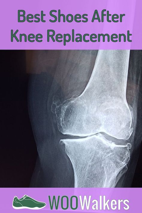 Pt For Knee Replacement, Full Knee Replacement Recovery, Exercise For Knee Replacement, Exercises Before Knee Replacement, Exercise After Knee Replacement, Preparing For Knee Replacement Surgery, Exercises After Knee Replacement Surgery, Knee Replacement Surgery Videos Total, Total Knee Surgery