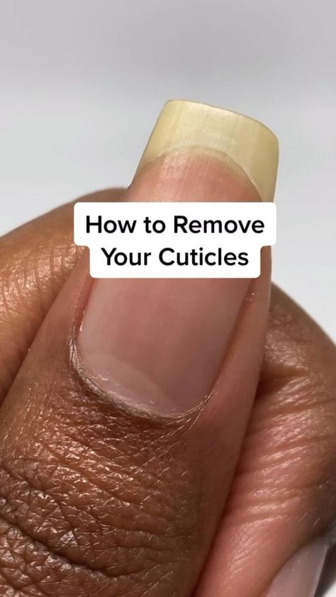 Fingernail fungus from acrylic nails How To Remove Cuticles, Clean Cuticles, Short Nails Natural, Cleaning Nails, Manicure Ideas For Short Nails, Nail Growth Tips, Remove Acrylic Nails, Diy Beauty Treatments, Cuticle Care