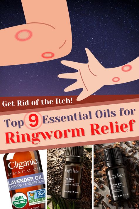 illustration of ringworm on arms and pictures of essential oils Ring Worm Essential Oils, Ring Worm Remedies, Aloe Vera For Sunburn, Remedies For Dry Mouth, Home Remedies For Allergies, Home Remedies For Warts, Oily Skin Remedy, Warts Remedy, Top Essential Oils