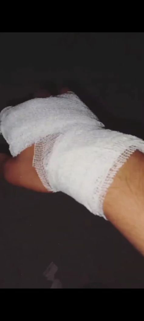 Hand Fracture Pics With Plaster, Injury Photoshoot, Bandaging Hands Aesthetic, Hand Dressing Photo Hospital, Leg Accident Real Pic In Hospital, Bandage On Hand Photo, Bandage Hands Snapchat, Accident Boys Dpz Hospital, Fake Hospitalized Snaps Hand