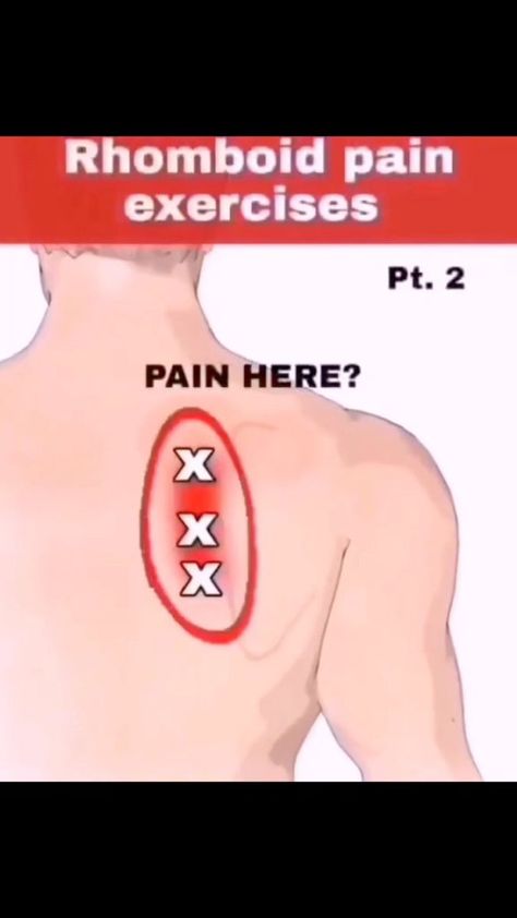 Shoulder Rehab Exercises, Neck Pain Exercises, Shoulder Pain Exercises, Neck And Shoulder Exercises, Body Massage Techniques, Yoga Facts, Body Pain Relief, Sciatica Exercises, Shoulder Pain Relief