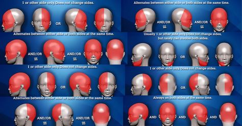 What is your location of headache meaning and what are headache placement meanings? Learn more from free headache charts, developed by a headache specialist. Headache Map, Types Of Headaches Chart, Headache Location Meaning, Headache Meaning, Headache Location, Headache Chart, Complex Migraine, Headache Medicine, Occipital Neuralgia