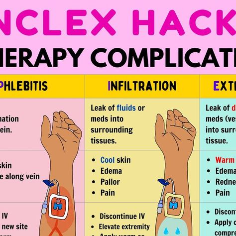 Infiltration Vs Phlebitis Nursing, Iv Therapy Nursing Notes, Iv Medication Administration, Iv Complications Nursing, Iv Fluids Nursing Cheat Sheets, Iv Placement, Iv Sites, Nursing Iv, Iv Insertion