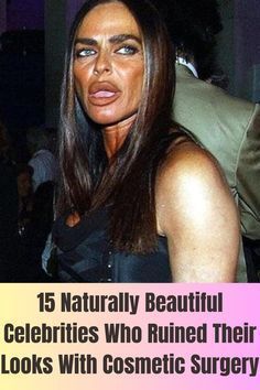 Plastic Surgery Pictures, Celebrity Surgery, Plastic Surgery Fail, Plastic Surgery Gone Wrong, Celebrity Plastic Surgery, Celebrity Facts, Fashion Fail, Nose Job, Cosmetic Procedures