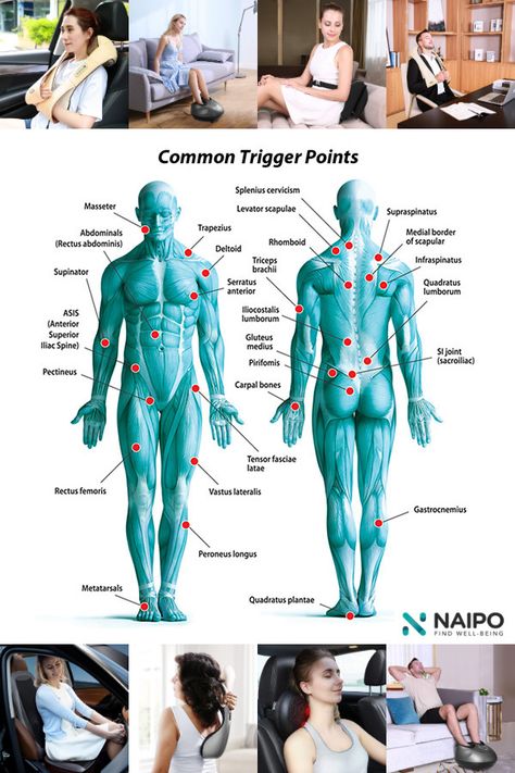 Muscle Trigger Points, Arm Massage Trigger Points, Trigger Point Therapy Muscle Knots, Psoas Release Trigger Points, Trigger Point Injections, Shoulder Trigger Points, Neck Muscle Anatomy, Trigger Point Release, Muscle Tear