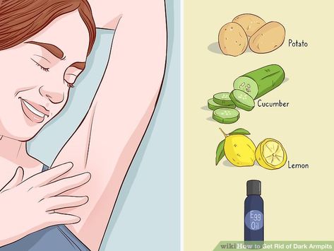 How to Get Rid of Dark Armpits: 12 Steps (with Pictures) - wikiHow Get Rid Of Dark Armpits, Acanthosis Nigricans, Black Armpits, Dark Armpits, Underarm Odor, Skin Lightener, Armpit Fat, Dark Underarms, Body Skin