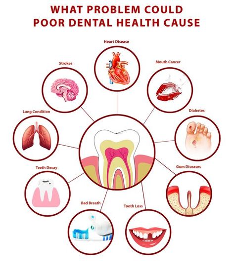 Dental Pictures, Dental Images, Dental Posts, Dental Posters, Dental Videos, Dental Fun, Dental Facts, Health Poster, Dental Cavities