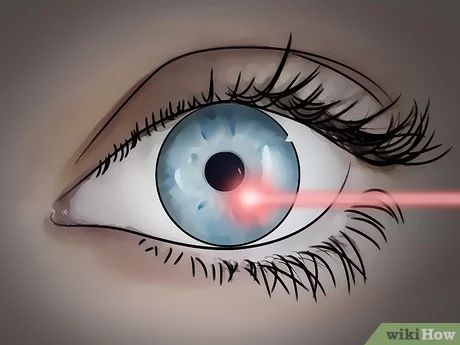 3 Ways to Get Rid of Eye Floaters - wikiHow Optometry Education, Eye Health Remedies, Eye Structure, Feet Massage, Eye Floaters, Eye Vision, Cold Relief, Eye Problems, Eye Sight