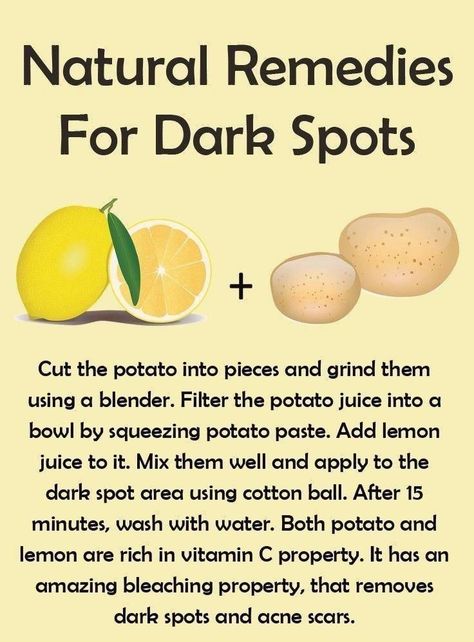 Potato Skin Care Dark Spots, Homemade Skin Care For Dark Spots, Potato Face Mask Dark Spots, Natural Remedies For Dark Spots, Natural Face Skin Care For Dark Spots, Fall Facials, How To Remove Dark Spots On Face, Turmeric Face Mask Dark Spots, Skin Treatments For Dark Spots