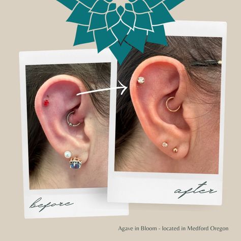 Jasper did a brilliant job helping this client find healing in her helix and daith piercings. While the process can take months, isn't that better than living with this kind of pressure and discomfort for months, too? We love to see it! Daith Piercings, Job Help, Daith Piercing, Helix, The Process, Our Love, See It, Piercings, Healing