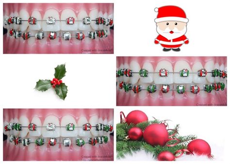 Dentaltown - I hope everyone has a safe and Merry Christmas! Braces Colors Christmas, Christmas Braces Color Ideas, Christmas Braces Colors, Christmas Braces, Braces Colours, Cute Braces Colors, Kids Braces, Adult Braces, Braces Tips