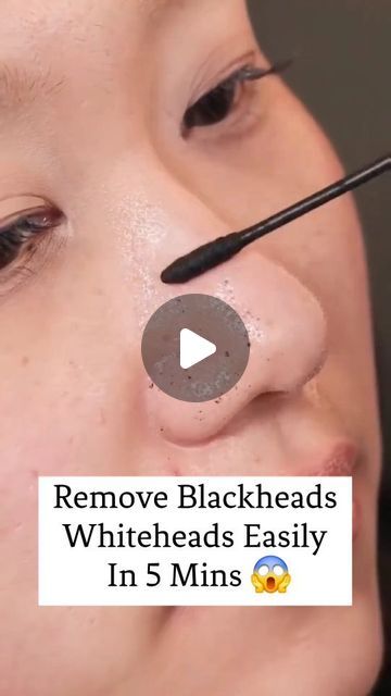 Glam In You on Instagram: "Remove Blackheads Whiteheads Easily In 5 Mins 😱 #reels   #reels #reelkarofeelkaro#reelsinstagram #reelsvideo #Instagram #reelkarofeelkaro #skincare #skincaretips #removeblackheads #blackheads #colgate #honey #milk  #tomato #aloevera #riceflour #removesuntan #clearskin #trend #trendingsong #jhakmaarke #viralsong #glam_in_you" How To Get Rid Of Blackheads, Removing Blackheads From Nose Videos, How To Remove Whiteheads, Diy Blackheads Removal, Neck Pimples, Best Peel Off Mask, Remove Blackheads From Nose, Honey Milk, Blackheads On Nose