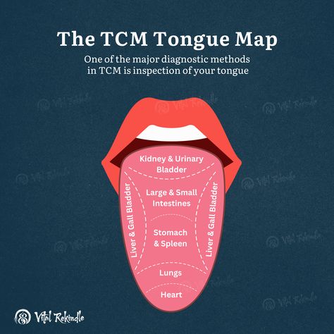 TCM Tongue Map Tongue Taste Buds, Herbal Teas, Traditional Chinese Medicine, Chinese Medicine, Health Issues, Traditional Chinese, Health Tips, Soups, Medicine