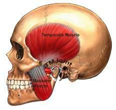 Dental Issues and Tinnitus | Arches Tinnitus Research Library. Find the connection between dental issues and tinnitus from this article on tinnitusformula.com to discover how to find tinnitus relief. Jaw Pain, Best Teeth Whitening, Natural Teeth Whitening, Joints Pain Relief, Dental Health, Oral Health, Teeth Whitening, Muscles, Anatomy