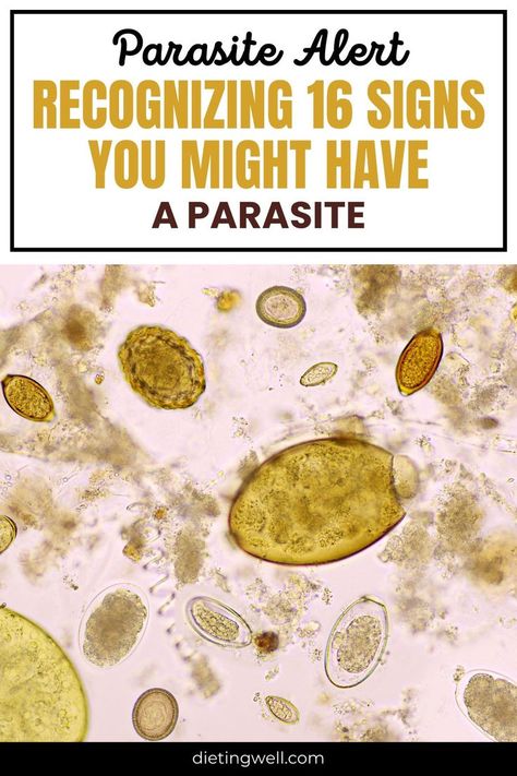 Human Parasites Pictures, Signs Of Parasites In Humans, Parasite Pictures, Parasites Symptoms, Natural Healing, Healthy Life, Keto Diet, Healthy Living, Health And Wellness