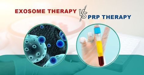 Exosome Therapy, Prp For Hair, Platelet Rich Plasma Therapy, Prp Therapy, Aesthetic Dermatology, Platelet Rich Plasma, Med Tech, Human Bones, Stimulate Hair Follicles