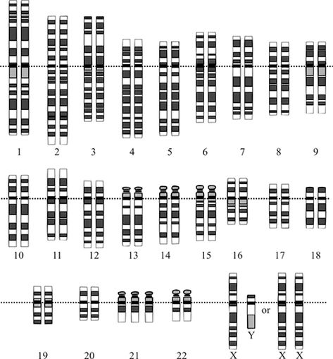 An illustration that shows 47 chromosomes organized into numbered homologous pairs, with the exception being location 21 that has three copies of that chromosome (one extra). Dna And Genes, Dna Molecule, Human Genome, Ap Biology, Reproductive System, Charles Darwin, Ancient Aliens, Biochemistry, Laura Lee