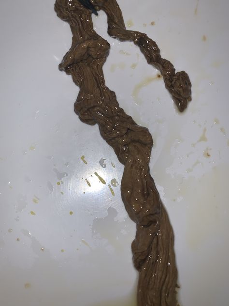 About Rope Worms – Rope Worms – What are They? Human Parasites Pictures, Tape Worm In Humans, Ribbon Worm, Hairstyles Natural Hair Black, Getting Rid Of Phlegm, Parasitic Worms, Easy Braided Hairstyles, Cleaning Your Colon, Natural Remedies For Migraines