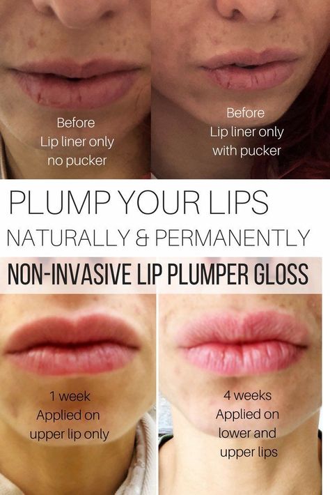 Plump your lips naturally and permanently, non-invasive lip plumper gloss, before and after shots #makeup #lips #gloss #lipstick #beauty Diy Lip Plumper, Lips Fillers, Lip Plumper Gloss, Plump Lips Naturally, Natural Lip Plumper, Diy Face Moisturizer, Lips Shape, Lips Gloss, Beauty Lips