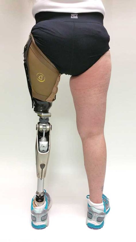 Above The Knee Amputee, Leg Prosthesis, Orthotics And Prosthetics, Prosthetic Leg, Metal Bending Tools, Mary Mary, Drawing Cartoon Characters, The Other Half, Other Half