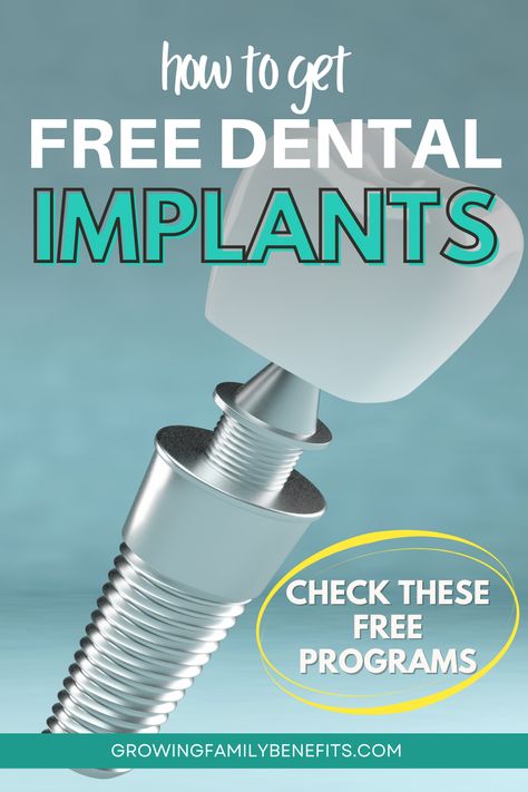 Struggling with the cost of dental care? Find out how to get free dental implants through grants and special programs designed to help those in need. Our detailed exploration covers everything from eligibility to application tips. Restore your smile and your confidence; learn more in this article. Clear Choice Dental Implants, Free Grants For Dental Implants, Free Dental Implants, Implants Dental, Affordable Dental Implants, Pinterest Tutorials, Dental Implants Cost, False Teeth, Dental Cosmetics