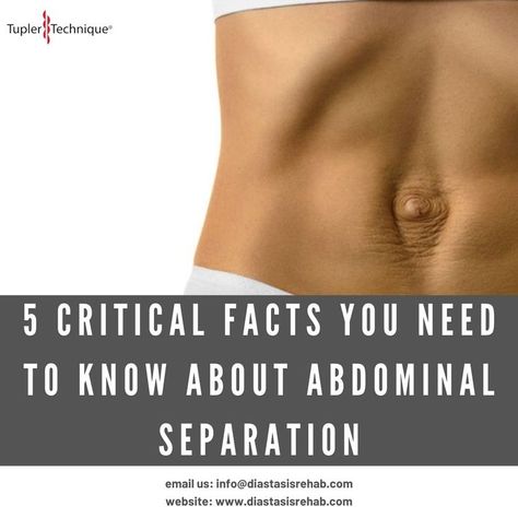 Learning more about diastasis recti? Read about the 5 critical facts you need to know about abdominal separation here: https://diastasisrehab.com/blogs/news/5-critical-facts-you-need-to-know-about-abdominal-separation #diastasis #protrusion #prolapse #wellness #bellybulge #mummytummy #dadbod #health #fitness #diastasisrecti #tupler #separation Mummy Tummy, Diastasis Recti Exercises, Diastasis Recti, Flat Belly, A Plus, Did You Know, Need To Know, Reading, Health