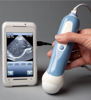 personal ultrasound machine for iphone - Google Search Baby Gadgets, Cool Baby, Foto Baby, Baby Time, Everything Baby, Cool Ideas, Ultrasound, Having A Baby, Future Baby