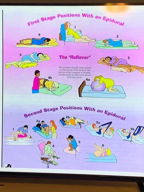 Epidural Labor Positions, Birthing Positions With Epidural, Birth Positions With Epidural, Labor Positions With Epidural, Epidural Birth Positions, Birthing Positions, Birth Positions, Epidural Birth, Labor Doula