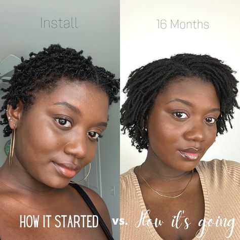 Microlocs Vs Sisterlocks, Micro Locs Short Hair, Short Microlocs Styles, Starter Microlocs, Short Microlocs, Locs Inspiration, Locs Journey, Dreadlocks Hairstyles, Short Locs