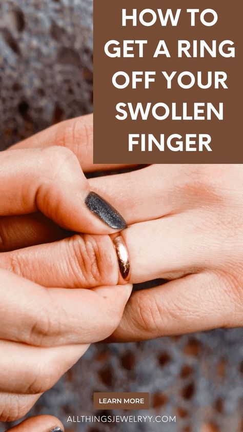 How To Get Stuck Ring Off Finger, Ring Removal Hack, How To Remove A Ring That Is Stuck, Get Ring Off Swollen Finger, How To Get A Stuck Ring Off Your Finger, How To Get A Ring Off Your Finger, How To Get A Ring Off A Swollen Finger, Ring Stuck On Finger, Ways To Be Healthier